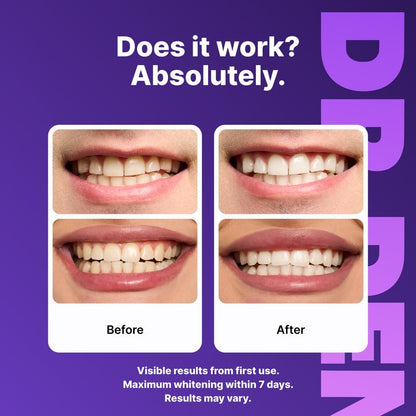 Whitening Strips